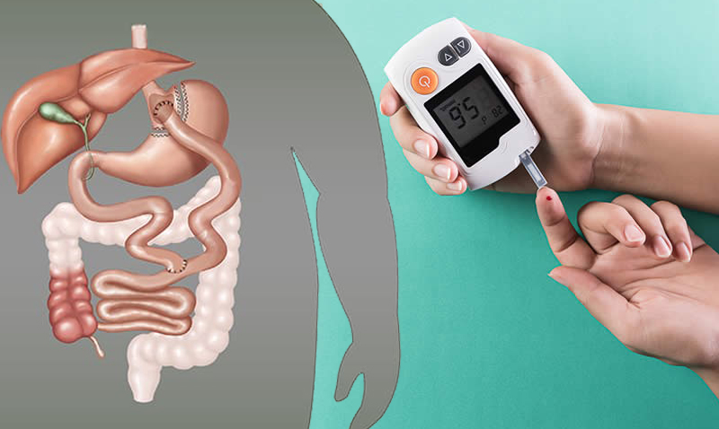 BIPARTITION OPERATION